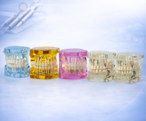 Dental Implant Pathological Tooth Model