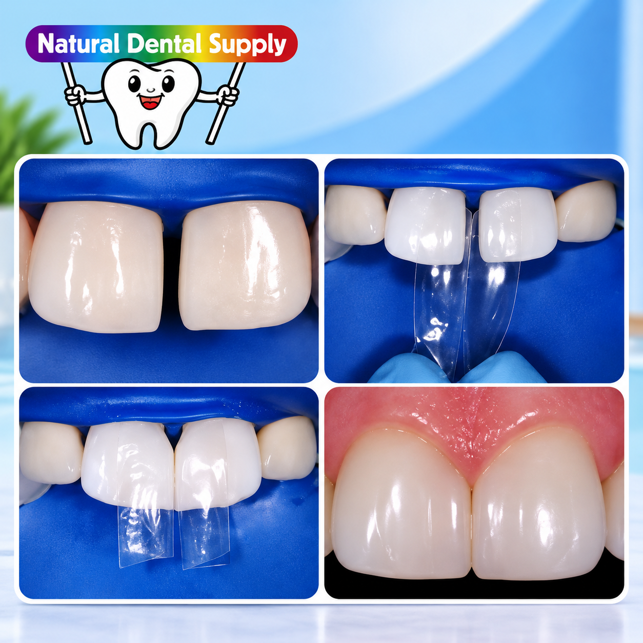 Natural Dental Supply_ Dental Strip Demonstration